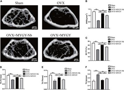 N-Butanol Extract of Modified You-Gui-Yin Attenuates Osteoclastogenesis and Ameliorates Osteoporosis by Inhibiting RANKL-Mediated NF-κB Signaling